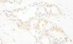 PRPF4B Polyclonal Antibody, Bethyl Laboratories 100 &mu;L; Unconjugated:Antibodies,