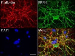 PRPH Mouse anti-Human, Clone: UMAB202, liquid, UltraMAB 100 &mu;L; Unconjugated:Antibodies,
