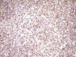 PRPH Monoclonal Antibody (OTI2D5), TrueMAB , OriGene 30 &mu;L | Buy Online | Origene Technologies | Fisher Scientific