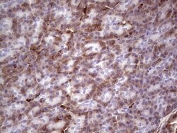 PRPH Mouse anti-Human, Clone: OTI1E10, lyophilized, TrueMAB 100 &mu;g;