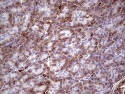 PRPH Monoclonal Antibody (OTI1E10), TrueMAB , OriGene 100 &mu;L; Unconjugated:Antibodies,