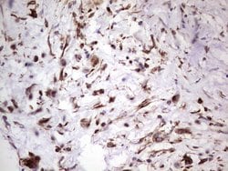 PRPH Monoclonal Antibody (OTI1E10), TrueMAB , OriGene 100 &mu;L; Unconjugated:Antibodies,
