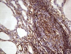 PRPH Monoclonal Antibody (OTI1E10), TrueMAB , OriGene 100 &mu;L; Unconjugated:Antibodies,