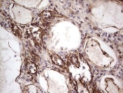 PRPH Mouse anti-Human, Clone: OTI1E10, lyophilized, TrueMAB 100 &mu;g;