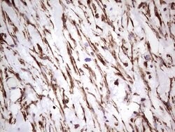 PRPH Mouse anti-Human, Clone: OTI1E10, lyophilized, TrueMAB 100 &mu;g;