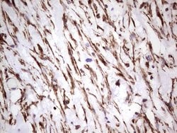 PRPH Monoclonal Antibody (OTI1E10), TrueMAB , OriGene 100 &mu;L; Unconjugated:Antibodies,