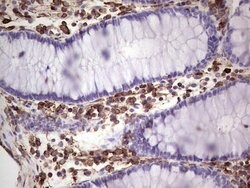 PRPH Mouse anti-Human, Clone: OTI1E10, lyophilized, TrueMAB 100 &mu;g;