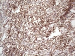 PRPH Mouse anti-Human, Clone: UMAB202, liquid, UltraMAB 100 &mu;L; Unconjugated:Antibodies,