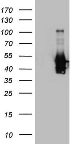 PRPH Mouse anti-Human, Clone: OTI1E10, lyophilized, TrueMAB 100 &mu;g;