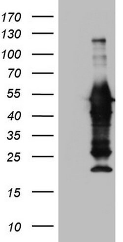 PRPH Mouse anti-Human, Clone: OTI3H1, lyophilized, TrueMAB 100 &mu;g; Unconjugated:Antibodies,
