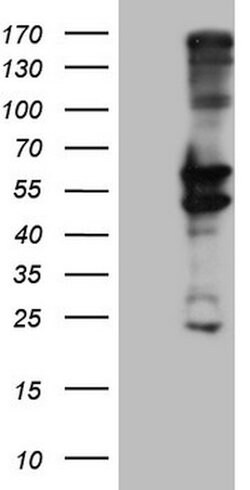 PRPH Mouse anti-Human, Clone: OTI4A2, lyophilized, TrueMAB 100 &mu;g; Unconjugated:Antibodies,