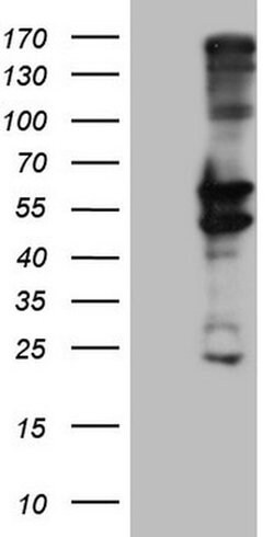 PRPH Monoclonal Antibody (OTI4A2), TrueMAB , OriGene 100 &mu;L; Unconjugated:Antibodies,