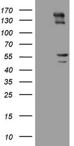 PRPH Monoclonal Antibody (OTI7E4), TrueMAB , OriGene:Antibodies:Primary