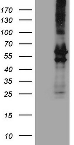 PRPH Mouse anti-Human, Clone: OTI8G3, lyophilized, TrueMAB 100 &mu;g; Unconjugated:Antibodies,