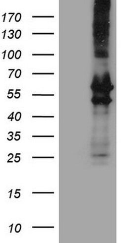 PRPH Monoclonal Antibody (OTI8G3), TrueMAB , OriGene 100 &mu;L | Buy Online | OriGene | Fisher Scientific