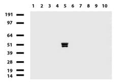 PRPH Mouse anti-Human, Clone: UMAB202, liquid, UltraMAB 100 &mu;L; Unconjugated:Antibodies,