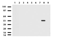 PRPH Mouse anti-Human, Clone: UMAB202, liquid, UltraMAB 100 &mu;L; Unconjugated:Antibodies,