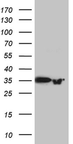 PRPS1L1 Mouse anti-Human, Clone: OTI2C6, lyophilized, TrueMAB 100 &mu;g;