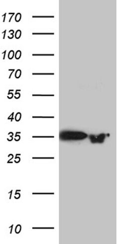 PRPS1L1 Monoclonal Antibody (OTI2C6), TrueMAB , OriGene 100 &mu;L; Unconjugated:Antibodies,
