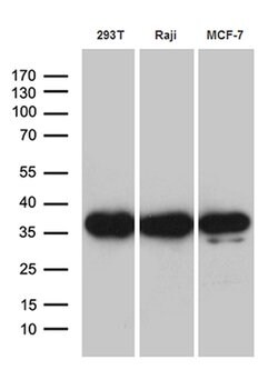 PRPS1L1 Mouse anti-Human, Clone: OTI2C6, lyophilized, TrueMAB 100 &mu;g;