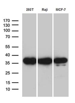 PRPS1L1 Monoclonal Antibody (OTI2C6), TrueMAB , OriGene:Antibodies:Primary