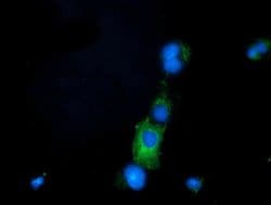 PRPSAP2 Monoclonal Antibody (OTI1E3), TrueMAB , OriGene 100 &mu;L; Unconjugated:Antibodies,
