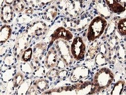 PRPSAP2 Monoclonal Antibody (OTI1E3), TrueMAB , OriGene 100 &mu;L; Unconjugated:Antibodies,