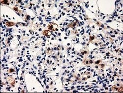 PRPSAP2 Monoclonal Antibody (OTI1E3), TrueMAB , OriGene:Antibodies:Primary