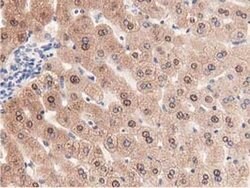 PRPSAP2 Monoclonal Antibody (OTI1E3), TrueMAB , OriGene 100 &mu;L; Unconjugated:Antibodies,