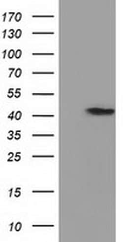 PRPSAP2 Monoclonal Antibody (OTI1E3), TrueMAB , OriGene 100 &mu;L; Unconjugated:Antibodies,