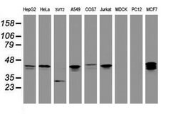 PRR11 Mouse anti-Human, Clone: OTI1A4, lyophilized, TrueMAB 100 &mu;g;