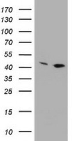 PRR11 Mouse anti-Human, Clone: OTI2A10, lyophilized, TrueMAB 100 &mu;g;