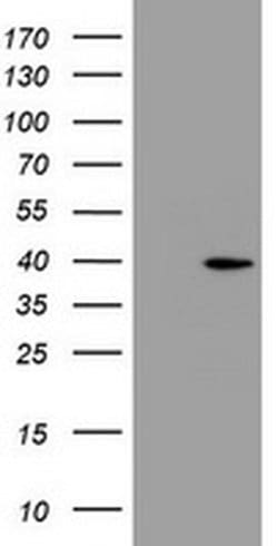 PRR11 Monoclonal Antibody (OTI5A8), TrueMAB , OriGene 100 &mu;L; Unconjugated:Antibodies,