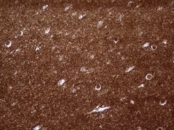 PRRT2 Mouse anti-Human, Clone: OTI9H8, lyophilized, TrueMAB 100 &mu;g;