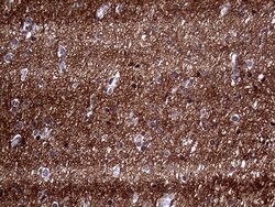 PRRT2 Mouse anti-Human, Clone: OTI9H8, lyophilized, TrueMAB 100 &mu;g;