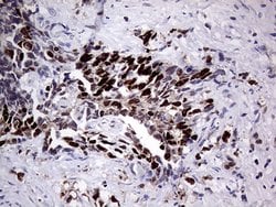 PRRT2 Mouse anti-Human, Clone: OTI9H8, lyophilized, TrueMAB 100 &mu;g;