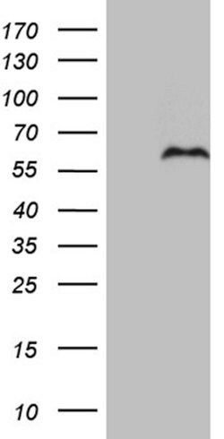 PRRT2 Mouse anti-Human, Clone: OTI9H8, lyophilized, TrueMAB 100 &mu;g;