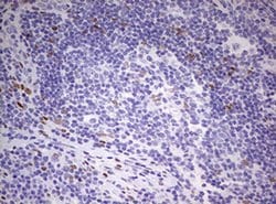 PRRX1 Monoclonal Antibody (OTI1C4), TrueMAB , OriGene:Antibodies:Primary