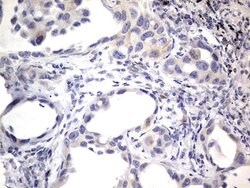 PRRX1 Mouse anti-Human, Clone: OTI1E10, lyophilized, TrueMAB 100 &mu;g;