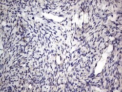 PRRX1 Mouse anti-Human, Clone: OTI1E10, lyophilized, TrueMAB 100 &mu;g;