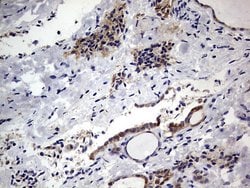 PRRX1 Mouse anti-Human, Clone: OTI1E10, lyophilized, TrueMAB 100 &mu;g;