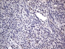 PRRX1 Mouse anti-Human, Clone: OTI1E10, lyophilized, TrueMAB 100 &mu;g;