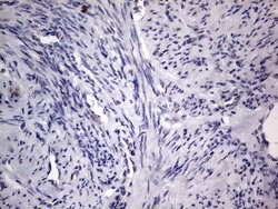 PRRX1 Mouse anti-Human, Clone: OTI1E10, lyophilized, TrueMAB 100 &mu;g;