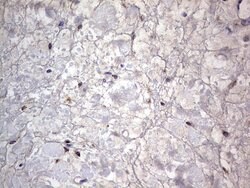PRRX1 Mouse anti-Human, Clone: OTI1E10, lyophilized, TrueMAB 100 &mu;g;