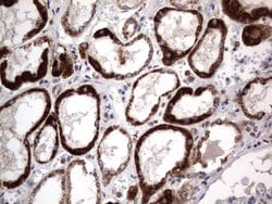 PRRX1 Mouse anti-Human, Clone: OTI1E10, lyophilized, TrueMAB 100 &mu;g;