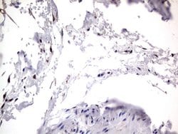 PRRX1 Mouse anti-Human, Clone: OTI1E10, lyophilized, TrueMAB 100 &mu;g;