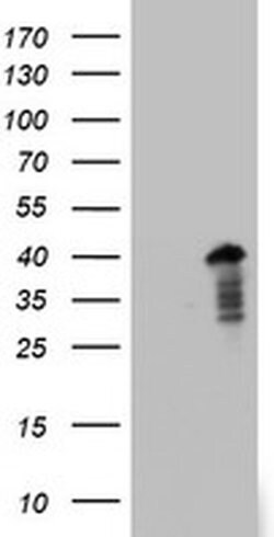 PRRX1 Monoclonal Antibody (OTI1C4), TrueMAB , OriGene 100 &mu;L; Unconjugated:Antibodies,