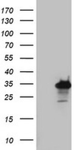 PRRX1 Mouse anti-Human, Clone: OTI1C2, liquid, TrueMAB 100 &mu;L; Unconjugated:Antibodies,