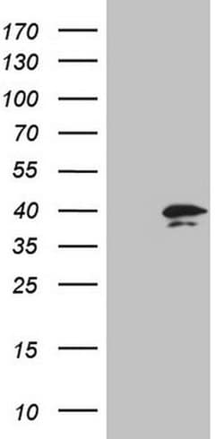PRTN3 Monoclonal Antibody (OTI1D10), TrueMAB , OriGene 100 &mu;L; Unconjugated:Antibodies,