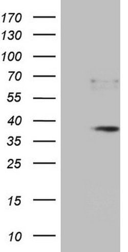 PRTN3 Mouse anti-Human, Clone: OTI6A10, lyophilized, TrueMAB 100 &mu;g;
